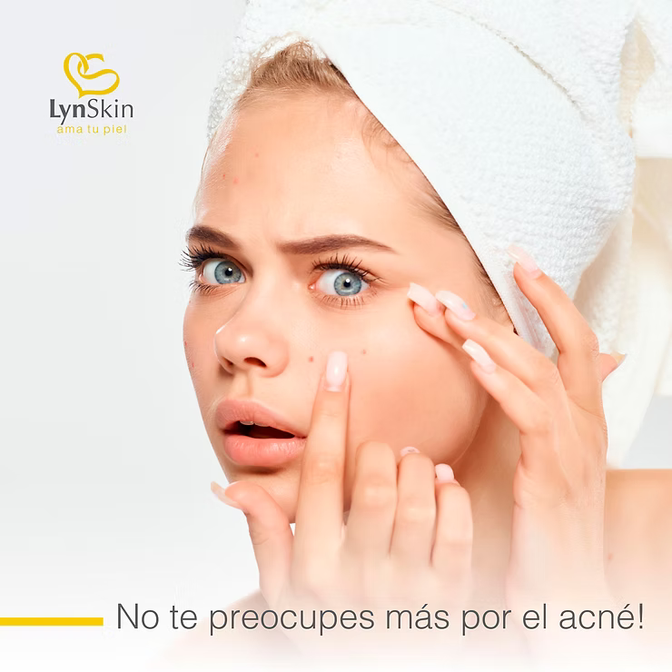 LynSkin acne