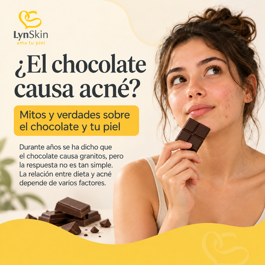 ¿El chocolate causa acné? Mitos, evidencia y lo que debes saber
