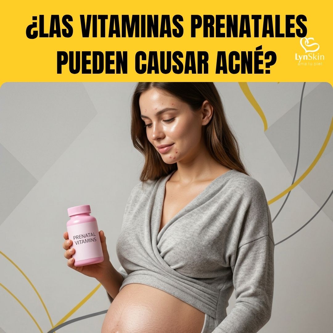 ¿Las vitaminas prenatales pueden causar acné?