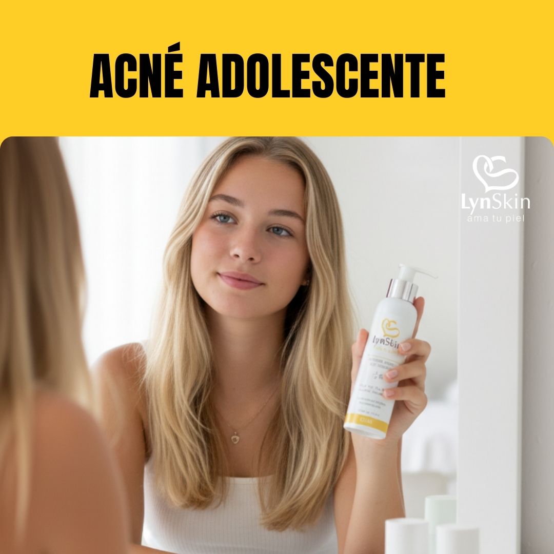 🧴 Rutina antiacné para adolescentes: cómo evitar cicatrices desde hoy