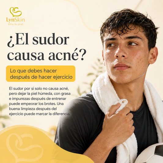 ¿El sudor causa acné? Lo que debes hacer después de hacer ejercicio